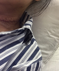 �װ�ȫ��+����ܰ���ɨ����ָ���