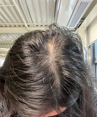 ����֬�����ѷ������ܲ����Σ�