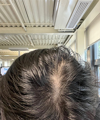 ����֬�����ѷ������ܲ����Σ�