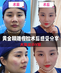 �������ѡ���˻ƽ𾫵�