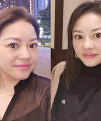 用这个方法,懒人也能轻松拥有小V脸