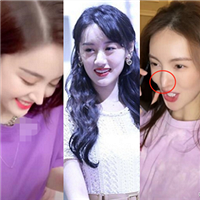 明明是美女,她们却毁在鼻子上