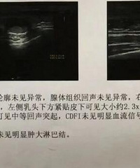 我男性,三十出头,得了乳腺癌