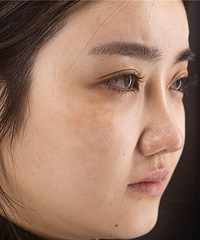 ���������Ƥ����ߣ�ֱ����Ƥ�ߺ�ȸ�����ƺͻָ�����