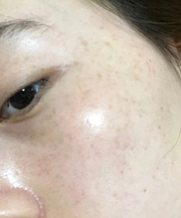 ��¼�µ�һ�η䳲Ƥ�����