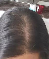 �����κ�ҩ�һ����ͷ���Աȣ����������