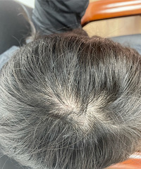 ��ͷ��������������