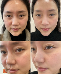 ��¼��һ��ҽ����˥���������º�����С��һȦ