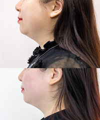 �ܹ����Ƥ�����ɣ������ʡ��Ŀ�˥������������Plus�����˽�