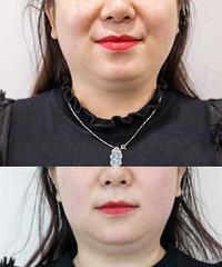 �ܹ����Ƥ�����ɣ������ʡ��Ŀ�˥������������Plus�����˽�