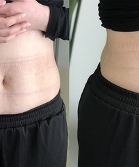 ����ҩ���˶�����ʳ�ļ��ʷ���2��һ���ֵ���ֽ��PK����˭�ݵ�