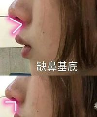 �����ơ�͹�죬��������Ҫ�ı��ֻ�Ǳǻ���