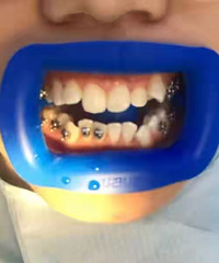 ͬ����һ�ξ۲��ϵ���˵�����������⻹�����⣿