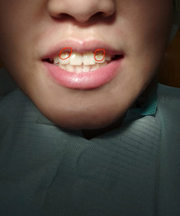 �����ǣ�һ��Ҫ�չ˺��Լ������ݣ�˵˵�ҵĲ���Ѫ��ʷ