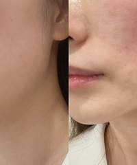 ��һ�ξ���Ч���Ŀ�˥��������35+����Ҳ�����������������