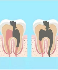 �����ж���������ǲ�������Ҫ����������