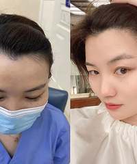 3小时“长”出真头发,也不是不可能!