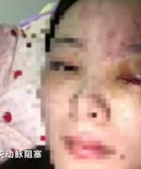 ����315���ᣬ�㻹����ҽ����