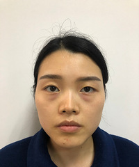 ���ս�һ���־�ȥ���۴����ˡ����滨�ú�ֵ