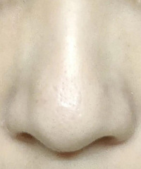 ����һ���罻�����ڶ��Ʋ�����ȥ��ͷ������