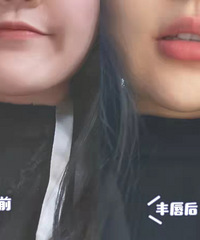 ��¼һ���Լ���һ�β�����ᴽ���ı�ô�