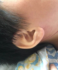 现实版死神来了!1男孩脚一滑,失足被“上吊”