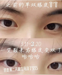 ��˫��Ƥѵ��������Ч�ĺ���ϲ��˫��Ƥ�Ŀ�������