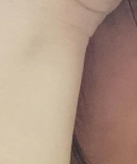 给大家看一下我手和脸的色差,有什么办法能解决?