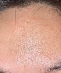 �бտ�����Ľ��ÿ���������Ƥ������˺ܶ���