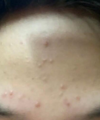 �бտ�����Ľ��ÿ���������Ƥ������˺ܶ���