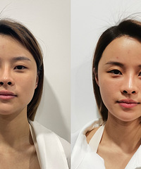 ��˥������֬���������������Ů����������fotona����