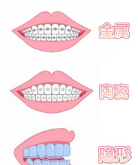 ���������̵㣬ѡ����Ч�����ã�