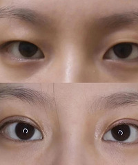 ˫��Ƥ���ĸ��£�������״���ܽ�~