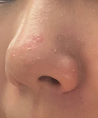 Ϊʲô�����ֳ�������Ƥ����