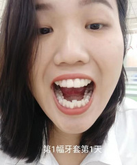 ��������ʱ����ʹ���׺ò��ã������з���Ȩ��