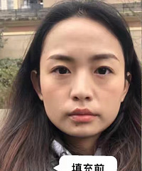 ���������ӡ�ڰ��ƣ��ҷ�����Ļ������᲻�٣�