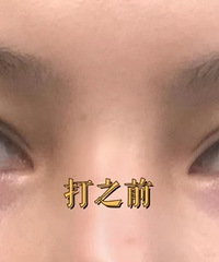 ��Ͳ�����˵˵��������ҽ����Ŀ��