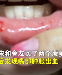 ���ڲ�֪��ԭ������û����ˮ��������ͻ���Ѫ��