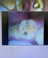 �찡�����ݵ�����һ��Ҫ���ȥ��ҽ��