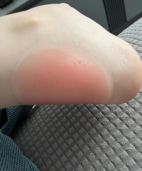 ������ĥyyds�������ǰ�������