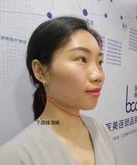 ǧ��Ҫ�ȿ����󣬲���������˥