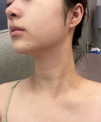 ���ھ��ƣ��������ӵĵ�һ���¾����������