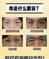 ���۴�֮ǰ�ǵ��˽�����Լ�����ʲô�۴�