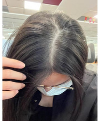 ��ͷ������֬����Ƥ�׵����л�Ҫ˵��