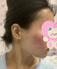 �����������Ľ����ǰ���һ����Ĥ�����Ѿ��ع��������ˣ�