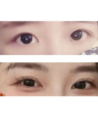 ��˫��Ƥ�����Ⱳ������ȷ�ľ�����