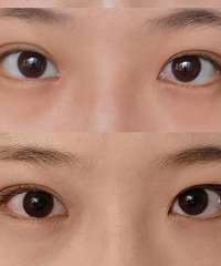 ����֢�Ļ��۷������۰����ڱ����