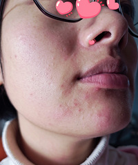 Ƥ��������ʹ����ߣ���������Щ���������������ȶ�������