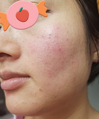 Ƥ��������ʹ����ߣ���������Щ���������������ȶ�������