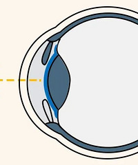 ICL����ֲ����������ʮ��ʮ�𣡿��ղ�������